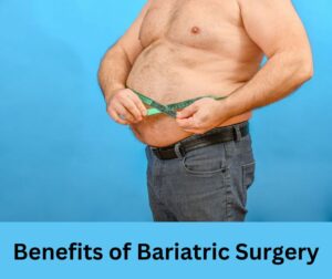 Best bariatric surgery in Faridabad