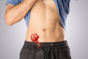 Dr Manu is top appendix doctor in Faridabad